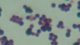 <p><b>Fig. 20:5.</b> Gram staining of <i>Staphylococcus aureus</i> subsp. <i>aureus</i>.</p>

<p> </p>