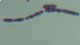 <p><b>Fig. 133:3.</b> Gram staining of <i>Bacillus subtilis</i> subsp. <i>subtilis</i>. The staining has not been efficient on all cells.</p>

<p> </p>