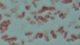 <p><b>Fig. 60:9.</b> Gram staining of <i>Mannheimia haemolytica</i>.</p>

<p> </p>