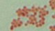 <p><strong>Fig. 87:3.</strong> Gram staining of <i>Aeromonas salmonicida</i> subsp. <i> salmonicida</i>.</p>

<p> </p>