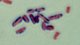 <p><strong>Fig. 29:3.</strong> Gram staining of <i>Clostridium perfringens</i>. Note that the cells have been stained irregularly.</p>

<p> </p>