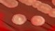 <p><strong>Fig. 21:2.</strong> Colonies of <em>Bacillus cereus</em> cultivated on bovine blood agar. Note the strong hemolysis zone. The total length of the scale bar corresponds to 10 mm.</p>

<p> </p>