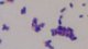 <p><strong>Fig. 13:3.</strong>Gram staining of <i>Listeria monocytogenes</i>, strain SLV365.</p>

<p> </p>