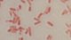 <p><strong>Fig. 142:3. </strong>Gram staining of <i>Citrobacter freundii</i>.</p>

<p> </p>