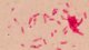 <p><strong>Fig. 61:5. </strong>Gram staning of <i>Nicoletella semolina</i>, strain BKT 9455/08.</p>

<p> </p>