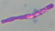 <p><b>Fig. 11:2.</b> Capsule staining with methylene blue of <i>Bacillus anthracis</i> from <b>from the outbreak of anthrax in Halland (Sweden) in December, 2008</b>. The bacteria were first cultivated on blood agar and then in horse serum during 6 h.</p>

<p> </p>