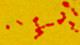 <p><strong>Fig. 57:2. </strong>Gram staining of <i>Actinobacillus pleuropneumoniae</i>, strain CCUG 12837T.</p>

<p> </p>