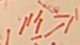 <p><strong>Fig. 104:3.</strong> Gram staining of <i>Dichelobacter nodosus</i>, strain .....</p>

<p> </p>