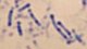 <p><strong>Fig. 104:2.</strong> Methylene blue (MB) staining of <i>Dichelobacter nodosus</i>, strain .... Note the typical dark granulae, particularly close to the ends, which can be visualized by MB staining.</p>

<p> </p>