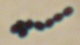 <strong>Fig. 190:3.</strong> Gram staining of <i>Enterococcus faecium</i>, strain VRE 300/04. <p>