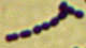 <strong>Fig. 15:4.</strong> Gram staining of <i>Streptococcus equi</i> subsp. <i>zooepidemicus</i>, strain VB 003/09. 
<p>