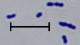 <p><b>Fig. 1:5.</b> Gram staining of <i>Trueperella pyogenes</i>, strain CCUG 13230<sup>T</sup>. The length of the scale bar corresponds to 5 µm. Date: 2010-05-21.</p>

<p> </p>