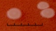 <p><b>Fig. 199:2.</b> Close up of colonies of <i>Mannheimia granulomatis</i>, strain BKT 20776/10, cultivated aerobically during 24 h on hematin agar at 37°C in the presence of 5% CO<sub>2</sub>. The total length of the scale bar corresponds to 5 mm. Date: 2010-06-02.</p>

<p> </p>