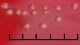 <p><b>Fig. 2.</b> Close up of colonies of <i>Erysipelothrix rhusiopathiae</i>, strain CCUG 221<sup>T</sup>, cultivated aerobically during 24 h on horse blood agar at 37°C in the presence of 5% CO<sub>2</sub>. The total length of the scale bar corresponds to 5 mm. Date: 2010-06-03.</p>

<p> </p>