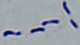 <p><b>Fig 3. </b>Gram staining of <i>Erysipelothrix rhusiopathiae</i>. Note the "cheese doodle" like appearence. The length of the scale bar is equivalent to 5 µm. Date: 2010-06-03.</p>

<p> </p>