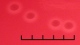 <p><b>Fig. 67:2.</b> Closeup of colonies of <i>Moraxella bovis</i>, strain BKT 14841/10, cultivated on horse blood agar during 24 h at 37°C in the presence of 5% CO<sub>2</sub>. Note the hemolysis around the colonies. Light from below. The length of the scale bar is equivalent to 5 mm. Date: 2010-10-06.</p>

<p> </p>