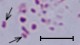 <p><b>Fig. 60:8.</b> Gram staining of <i>Mannheimia haemolytica</i>, strain PAT 4483/10. The bacteria at the arrows are probably dividing. The length of the scale bar corresponds to 5 µm. Date: 2010-10-06.</p>

<p> </p>