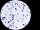 <p><b>Fig. 205:4.</b> Gram staining of <i>Staphylococcus epidermidis</i>, strain VB 005/11. The length of the scale bar is equivalent to 5 µm. Date: 2011-03-14.</p>

<p> </p>