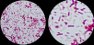 <p><b>Fig. 65:6.</b>Gram staining of <i>Pseudomonas aeruginosa</i>, strain ATCC 27853. The field B is a partial magnification (3 times) of A. The length of the scale bar corresponds to 5 µm. Date: 2011-03-24.</p>

<p> </p>