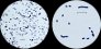 <b>Fig. 19:3.</b> Gram staining of <i>Streptococcus uberis</i>, strain VB 004/11. Degree of magnification and field of view differ between the two pictures. The length of the scale bar is in both pictures equivalent to 5 µm. Date: 2011-04-11. <p>