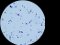 <b>Fig. 207:5.</b> Gram staining of <i>Streptococcus canis</i>, strain CCUG 37323. The length of the scale bar is equivalent to 5 µm. Date: 2011-06-08. <p>