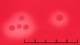 <b>Fig 207:1.</b> Close-up of colonies of <i>Streptococcus canis</i>, strain CCUG 37323, cultivated aerobically on bovine blood agar with aesculine at 37 °C during 24 h. Photographed with lighting from below. Note the relatively broad hemolysis zone, which can be observed around the colonies. The length of the scale bar is equivalent to 5 mm. Date: 2011-06-08 <p>