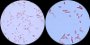 <p><b>Fig 156:5.</b> Gram staining of <i>Klebsiella oxytoca</i>, strain CCUG 15717 at two different degrees of magnification (A and B). The lengths of the scale bars are equivalent to 5 µm in both images. Date: 2011-08-30.</p>

<p> </p>