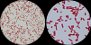 <p><b>Fig 69:4.</b> Gram staining of <i>Klebsiella pneumoniae</i> subsp. <i>pneumoniae</i>, strain CCUG 225 at two different degrees of magnification (A and B). The lengths of the scale bars are equivalent to 5 µm in both images. Date: 2011-08-30.</p>

<p> </p>