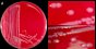 <p><b>Fig. 70:1</b> Colonies of <i>Salmonella enterica</i> subsp. <i>enterica</i> serovar Dublin, strain SLV 242, cultivated on bovine blood agar at 37°C during 24 h. A and B, with lighting primarely from above. C, with lighting primarerly from the side. Note the for salmonella typical cone shaped appearence of the colonies, which is best observed in C. The total lengths of the scale bars are equivalent to A, 1 cm; B and C, 5 mm. Date: 2012-01-19.</p>

<p> </p>