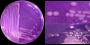 <b>Fig. 70:3</b> Colonies of <i>Salmonella enterica</i> subsp. <i>enterica</i> serovar Dublin, strain SLV 242, cultivated on purple agar with lactose at 37°C during 24 h. A and B, with lighting primarely from above. C, with lighting primarirly from the side. Note the for salmonella typical cone shaped appearence of the colonies, which is best observed in C. The pale colonies around the arrow in C are i fact mirror images of colonies above. Thus, these colonies are seen from underneath (c.f. C, which shows the same area of the agar plate. The total lengths of the scale bars are equivalent to A, 1 cm; B and C, 5 mm. Date: 2012-01-19.
<p>