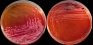 <p><strong>Fig. 70:7.</strong> Colonies of <i>Salmonella enterica</i> subsp. <i>enterica</i>, serovar Diarizonae, cultivated aerobically on BG agar (A) and XLD+N-agar (B) at 37°C during 24 h. Note that there is no yellow colour around the colonies (in A) since salmonellas are lactose negative and black colonies (in B). The length of the scale bars is equivalent to 1 cm.</p>

<p> </p>