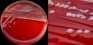 <p><b>Fig. 53:1</b>. Colonies of <i>Bordetella bronchiseptica</i>, strain xxx, cultivated on bovine blood agar at 37°C during 48 h. Lighting from above during photography. B is a partial close-up of A. The length of the scale bars in A and B corresponds to 10 and 5 mm, respectively.</p>

<p> </p>