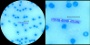 <p><strong>Fig. 11:3.</strong> Capsule staining with methylene blue of <em>Bacillus anthracis</em> in a blood smear. A "chain" of bacteria can be seen under the scalebars. The right image is a close-up of the left one. The lengths of the scale bars are equivalent to 10 µm i both images.</p>

<p> </p>