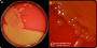 <p><strong>Fig. 14:1.</strong> Image A. Colonies of <i>Streptococcus equi</i> subsp. <i>equi</i> cultivated on bovine blood agar at 37 °C during 48 h. The agar plate was photographed <strong>with light from bellow</strong>.  Image B. Close-up of some colonies from the agar plate to the left. The β-hemolysis is difficult to see, but it is more easily observed with light from below. The total length of the scale bars is equivaleent to 1 cm and 3 mm, respectively. Date: 2022-01-23.</p>

<p> </p>