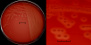 <p><strong>Fig. 16:2.</strong> A. Colonies of <i>Streptococcus agalactiae</i> cultivated, strain VB 0006/11, on bovine blood agar at 37 °C during 24 h. The agar plate was photographed <strong>with light from below</strong>. B. Close-up of some colonies from the agar plate to the left. The clear Î²-hemolysis can easily be seen in both panels. This strain has a coparatively broad zon of hemolysis. The total length of the scale bars is equivalent to 1 cm and 3 mm, respectively. Date: 2014-11-12.</p>