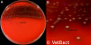 <strong>Fig. 15:1.</strong> A. Colonies of <i>Streptococcus equi</i> subsp. <i>zooepidemicus</i> cultivated on bovine blood agar at 37 °C during 48 h. The agar plate was photographed <strong>with light from above</strong>. B. Close-up of some colonies from the agar plate to the left. The β-hemolysis can bee seen in both panels, but it is more easily observed with light from below (see Fig. 15:2/3). The total length of the scale bars is equivaleent to 1 cm. Date: 2014-11-24.</p>