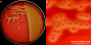 <p><strong>Fig. 121:2.</strong> Colonies of <i>Streptococcus dysgalactiae</i> subsp. <i>equisimilis</i>, strain CCUG 36637, cultivated aerobically on bovine blood agar during 24 h at 37°C. The lighting is from and the hemolysis can easily be seen (c.f. Fig. 121:2). B shows a close-up of the plate in B. The total length of the scale bars is equivalent to 10 and 3 mm in A and B, respectively. Date: 2015-09-02.</p>

<p> </p>