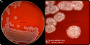 <p><strong>Fig 12:1.</strong> Colonies of <em>Bacillus licheniformis</em>, cultured aerobically on bovine blood agar at 37°C during 24 h. The lengths of the scale bars in A and B are equivalent to 10 and 6 mm, respectively.</p>

<p>Date: 2020-06-25.</p>