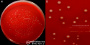 <strong>Fig. 188:1.</strong> Colonies of <i>Treponema pedis</i>, strain TA 4, cultivated anaerobically on an FAA plate at 37°C during 8 days. Image B is a close-up of the plate in  image A. The lengths of the scale bars in A and B are equivalent to 10 and 5 mm, respectively. <strong>Lighting from above</strong> during photography. Date: 2016-03-18.</p>