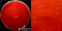 <p><strong>Fig. 139:1.</strong> Colonies of <i>Treponema phagedenis</i>, strain V1, cultivated anaerobically on an FAA plate at 37°C during 8 days. Image B is a close-up of the plate in image A. The lengths of the scale bars in A and B are equivalent to 10 and 5 mm, respectively. <strong>Lighting from above</strong> during photography. It is difficult to discern the colonies, because they are very thin. Date: 2016-03-18.</p>

<p> </p>