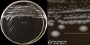 <p><strong>Fig. 109:3.</strong> Colonies of <i>Campylobacter coli</i>, strain SLV427, cultivated microaerophilically on a CCDA plate at 37°C during 48 h. A, overview of the plate; B, close-up. The lengths of the scale bars are equivalent to 10 and 5 mm, respectively. Date: 2016-05-26.</p>

<p> </p>