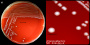 <strong>Fig. 124:1.</strong> Colonies of <i>Enterococcus faecalis</i>, strain CCUG 9997, cultivated on bovine blood agar during 24 h at 37°C. The image A shows the whole plate and image B is a close-up of A. The total length of the scale bars is equivalent to 10 and 3 mm, respectively. Date: 2016-10-17.</p>