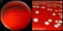 <strong>Fig. 190:1.</strong> Colonies of <i>Enterococcus faecium</i>, VRE strain, cultivated on bovine blood agar during 24 h at 37°C. The image A shows the whole plate and image B is a close-up of A. The total length of the scale bars is equivalent to 10 and 3 mm, respectively. Date: 2016-10-18.</p>