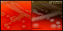 <p><strong>Fig. 85:2.</strong> Colonies of <i>Listonella anguillarum</i> cultivated on bovine blood agar at 30°C. A. Cultivation during 24 h; B. Cultivation during 48 h. The images A and B are close-ups of Fig. 85:1 A and B, respectively. The total length of the respective scale bars is equivalent to 4 mm.</p>