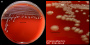 <p><strong>Fig. 71:1.</strong> Colonies of <i>Plesiomonas shigelloides</i> cultivated on bovine blood agar at 37 °C during 24 h. Image B is a close-up of image A. The length of the scale bar is equivalent to 1 cm and 3 mm, respectively. Date: 2016-11-02.</p>

<p> </p>