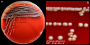 <p><strong>Fig. 87:1.</strong> Colonies of <i>Aeromonas salmonicida</i> subsp. <i>salmonicida</i> cultivated on bovine blood agar at ambient temperature during 48 h. Image B is a close-up of image A. The length of the scale bar is equivalent to 1 cm and 3 mm, respectively. Date: 2016-11-02.</p>

<p> </p>