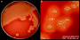 <p><strong>Fig. 126:1</strong> Colonies of <i>Dermatophilus congolensis</i> cultivated on blood agar during 5 days at 37°C and in 5% CO<sub>2</sub>. Note the strong hemolysis and the irregular edge of the colonies. Image A shows the whole plate och and image B a partial close-up. The length of the scale bars is equivalent to 1 cm and 5 mm, respectively. Date: 2017-08-29.</p>