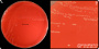 <p><strong>Fig. 264:1.</strong><em> Filifactor villosus</em> cultivated on bovine blood agar in anaerobic atmosphere. The  image A shows the whole plate and image B is a partial close-up of some colonies. The length of the scale bar is equivalent to 10 mm in image A and 3 mm in image B.  Date: 2020-05-16.       </p>