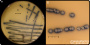 <p><strong>Fig. 20:11. </strong>Methicillin Resistant <em>Staphylococcus aureus </em>(MRSA) cultured on chromogenic MRSA agar during 24 hours at 37<span style="font-size:11pt"><span style="line-height:115%"><span new="" roman="" style="font-family:" times="">°</span></span></span>C in aerobic atmosphere. The length of the scale bars in A and B are equivalent to 10 and 3 mm, respectively.</p>