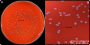 <p><strong>Fig 260:1.</strong> Colonies of <em>Enterococcus hirae</em>, cultured aerobically on bovine blood agar at 37°C during 24 h. The lengths of the scale bars in A and B are equivalent to 10 and 3 mm, respectively.</p>

<p>Date: 2023-01-26.</p>